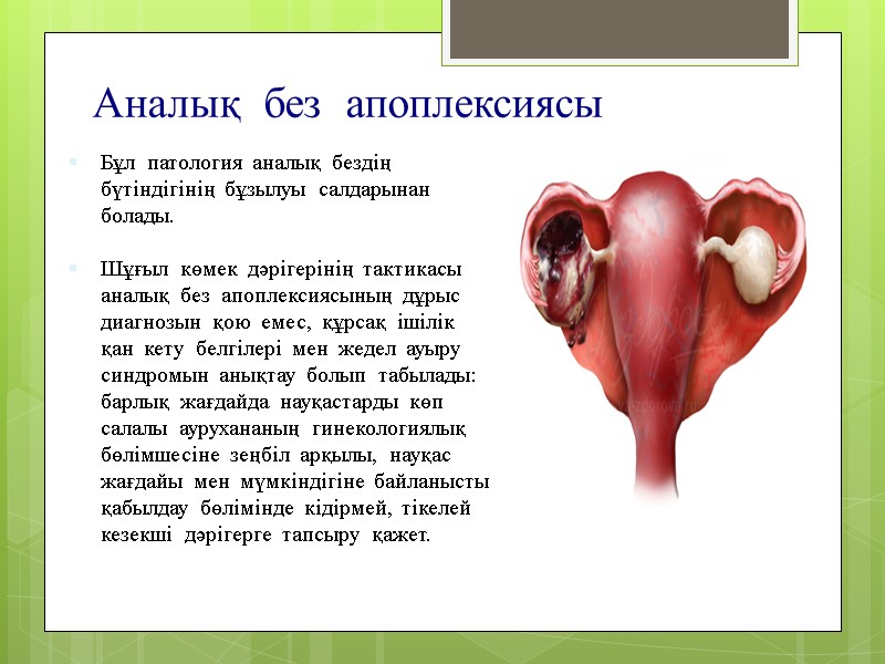 Аналық  без  апоплексиясы Бұл  патология  аналық  бездің  бүтіндігінің